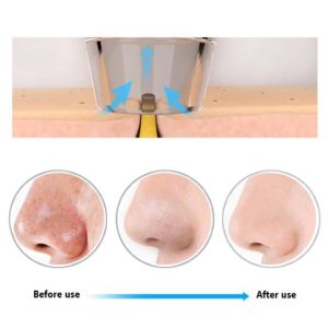 Electric Blackhead Acne Suction Instrument Pore Cleaner Removes