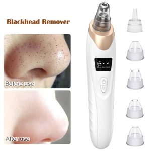 Electric Blackhead Acne Suction Instrument Pore Cleaner Removes