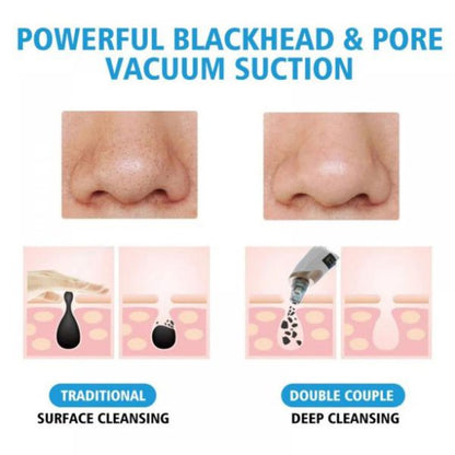 Electric Blackhead Acne Suction Instrument Pore Cleaner Removes